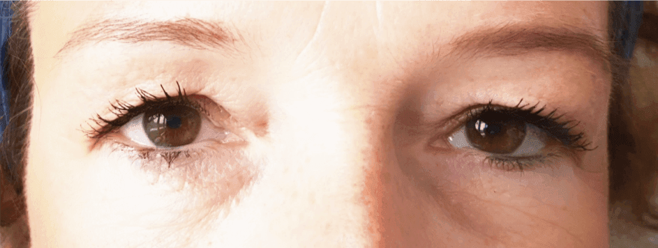LashLink – Ihr Spezialist für langlebige Wimperverlängerung Wimpern