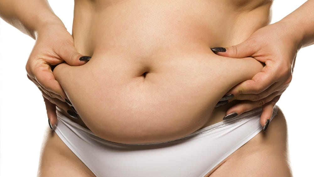 Anzeichen Lipödem erkennen: So verläuft eine ärztliche Diagnose