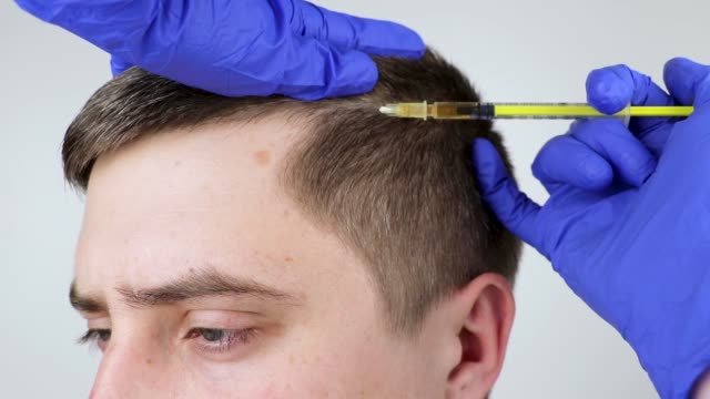 Haarausfall Nürnberg: Individuelle Lösungen für Hautstraffung und Faltenbehandlung bei MY AESTHETICS